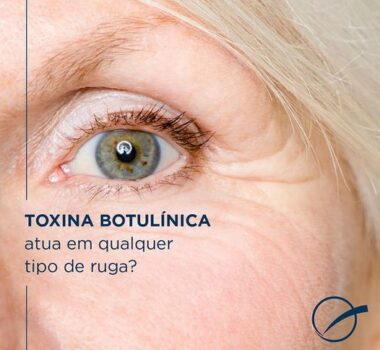 A Toxina Botulínica atua em qualquer tipo de ruga?