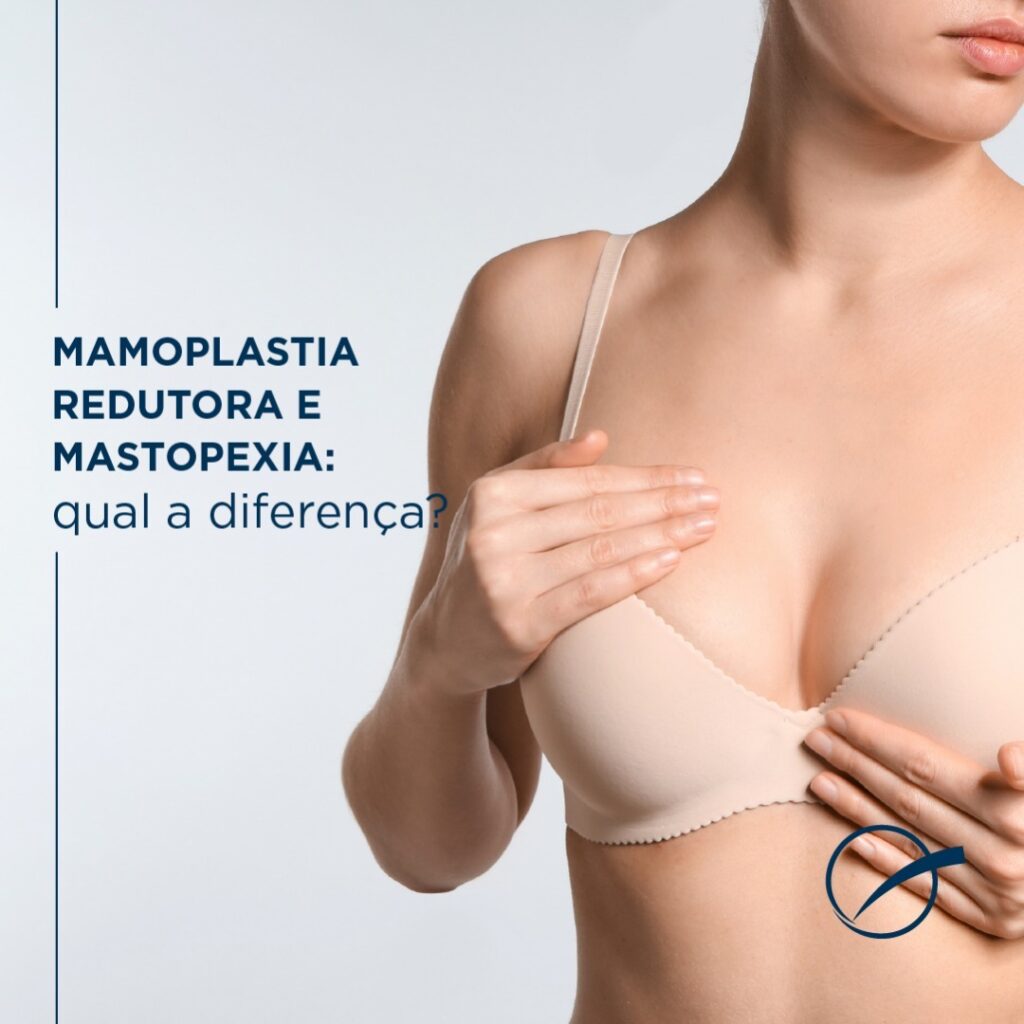Diferença entre Mamoplastia Redutora e Mastopexia